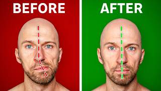 Fix Asymmetrical Jaw amp Face In Under 1 Minute a Day [upl. by Brockie485]