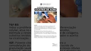 Ativos para microagulhamento em ACNE [upl. by Feigin209]