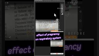 5 EFFECTS OF PREGNANCY ON RESPIRATORY SYSTEM  EFFECTS OF PREGNANCY ON LUNG VOLUMES AND CAPACITIES [upl. by Verdi]