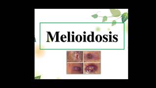 Melioidosis [upl. by Ackler]