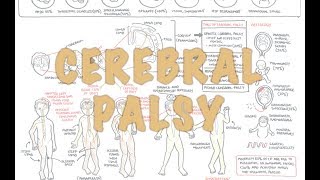 Cerebral Palsy  DETAILED Overview [upl. by Dorrehs]