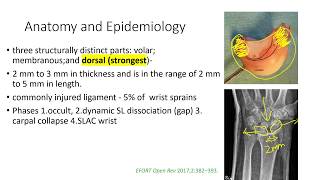 Scapholunate Ligament Injuries [upl. by Liza]