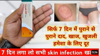 clorash gm cream  antifungal cream  दाद खाज खुजली की दवाई  क्लोराश जीएम क्रीम [upl. by Anitirhc]