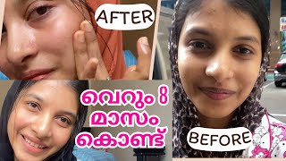 💯😳quotഎങ്ങനെ ഇത്ര glow ആയി quot My skin care products  Selmadinash [upl. by Kera120]