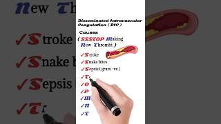 Causes of Disseminated Intravascular Coagulation  DIC [upl. by Assinna111]