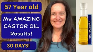 I USED CASTOR Oil for 30 DAYS  AMAZING Results 💥 [upl. by Llenehs]