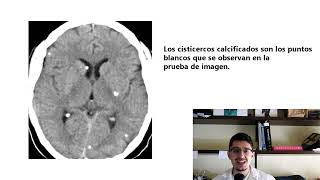 🔴​ CISTICERCOSIS y NEUROCISTICERCOSIS Síntomas TRATAMIENTO y prevención de esta enfermedad [upl. by Otnas272]