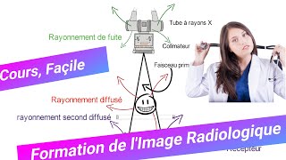 Formation dImage Radiologique Le rayonnement Diffusé Bases Physiques dImagerie Médicale [upl. by Linda]