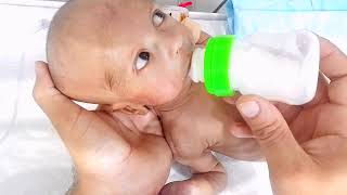 crazy Baby Good Feeding videocleft palate baby [upl. by Kciredohr]