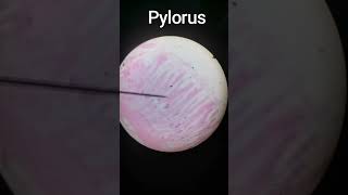 Pylorus [upl. by Arlon]