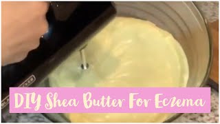 DIY Whipped Shea Butter For Eczema Seborrheic Dermatitis  Only 2 Ingredients  NATURAL HAIR [upl. by Nawyt]