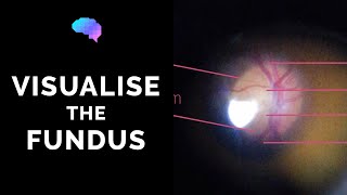 Fundoscopy  How to Visualise the Fundus  Direct Ophthalmoscopy  OSCE Guide  UKMLA  CPSA [upl. by Alaj]