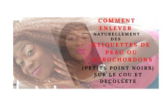 Comment enlever naturellement les Etiquettes de Peau ou Acrochordons Points Noirs CouDecollete [upl. by Eirrek]