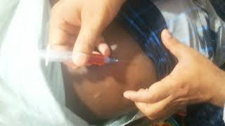 Buttock im injection push Vitamin B1B6  B12 Neuralgin injection The IBN SINA Pharma  Ep35 [upl. by Anniroc]