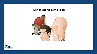 Klinefelters Syndrome [upl. by Sherline]