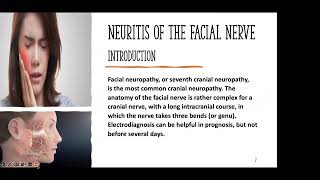 56 Neuritis of the facial nerve [upl. by Ettesyl]