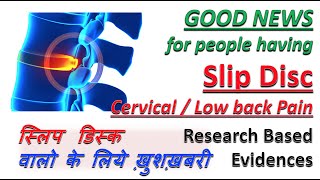 Good News for Slip Disc PIVD Sciatica  Research Based  स्लिप डिस्क  Cervical amp Low Back Pain [upl. by Aisenet]