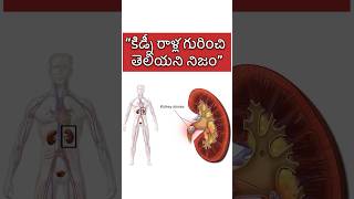 Unknown facts about kidney stones kidneystone telugufacts health [upl. by Leiser]