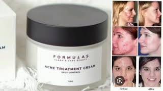 ACNE TREATMENT CREAM SPOT CONTROL FORMULAS CLEAN amp CARE BEAUTY [upl. by Odnalo771]