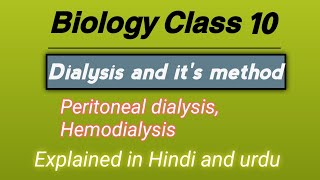 quotHemodialysis vs Peritoneal Dialysis Which is Right for YouquotExplained in Hindi and urdu [upl. by Anaujd]