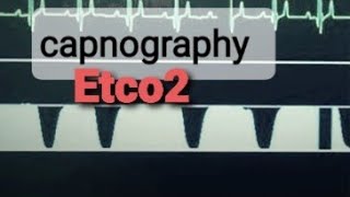 Etco2 capnography use and types [upl. by Ahsinet]