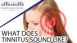 What Does Tinnitus Sound Like [upl. by Menedez]