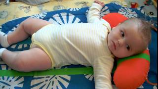 Evan six months infantile spasms  West Syndrome [upl. by Tedra506]