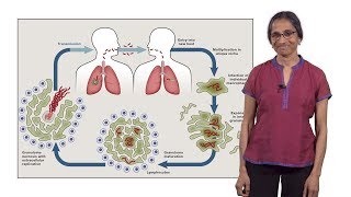 Lalita Ramakrishnan Cambridge 1 Tuberculosis The Pathogenic Personality of the Tubercle bacillus [upl. by Ennaer]