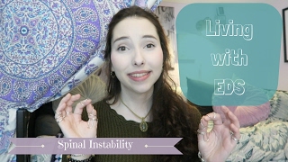 Living with EDS Spinal Instability [upl. by Woodberry946]