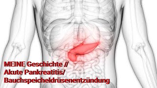 MEINE Geschichte  Akute PankreatitisBauchspeicheldrüsenentzündung [upl. by Kcirret]