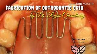 Fabrication of orthodontic tongue crib habit breaker appliance by Dr Rajni [upl. by Ridglee]