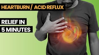 Reduce Your Heart Burn  GERD In 5 Mins  Acid Reflux Treatment [upl. by Aivekal]