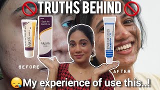 🚫My Experience of using of Glyco 6 amp RetinoA Cream😱✅Merits and Demerits ❌It is this worth or not🤔 [upl. by Ahsercel]