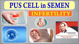 Semen me Pus Cell Kyu Aata Hai Pus Cell In Semen Treatment DrProf Santosh Kumar PGI [upl. by Domash]