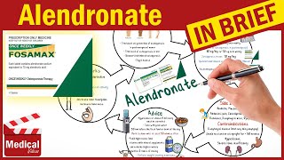 Alendronate Sodium 70 mg Fosamax What is Alendronate used for Fosamax Uses Dosage Side Effects [upl. by Anilek]