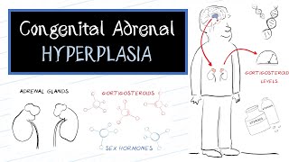 What is Congenital Adrenal Hyperplasia CAH [upl. by Anelra464]