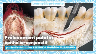 🦷 La chirurgie mucogingivale  le prélèvement épithélioconjonctif avec les Drs RZEZNIK amp JALLADAUD [upl. by Llerrit]