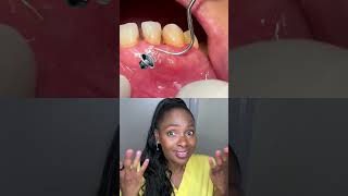 Dental Hygienist reacts shorts reaction [upl. by Simon394]