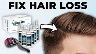 Men How To Fix Hair Loss At Home Full Guide [upl. by Jenine]