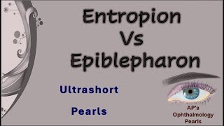 Entropion vs Epiblepharon│ Ultrashort Pearls 13 [upl. by Jariah]