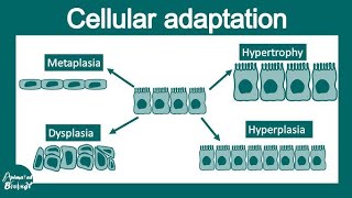 metaplasiahyperplasiahypertrophy and atrophy [upl. by Fulks]