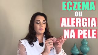 ALERGIA NA PELE  ECZEMA  O QUE É [upl. by Neetsyrk]