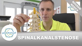 Spinalkanalstenose  Enge im Spinalkanal [upl. by Ressay]