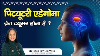 Pituitary Adenoma क्या होता है क्या Pituitary Adenoma सच में Brain Tumor है Dr Tanvi Mayur Patel [upl. by Lanahtan313]