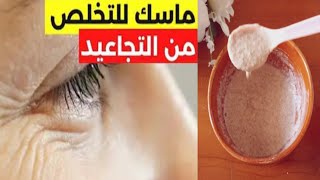 وصفة لتبييض الوجه من حروق الشمس والتصبغات الداكنة❗️wasfa li tabyid lwajh ✅️ [upl. by Alexina428]