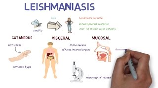 What is Leishmaniasis An introduction and overview [upl. by Micheil]