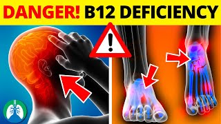 ⚠️ Top 10 DANGERS of Vitamin B12 Deficiency ▶ BEWARE ❗ [upl. by Aia164]