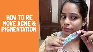 How this Ointment Works 100 Spotless Glowing Skin in Telugu  Remove Pigmentation just in Week [upl. by Htebarual661]