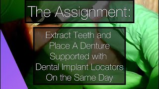 Selective Extractions and Implant Placement for Locator Attachments [upl. by Hamlen]