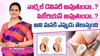 Myths And Facts About Normal Vs Cesarean Delivery  DrMythrayi  Mythri Sri Fertility Centre [upl. by Aicnelav]